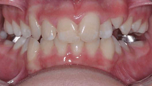 Before