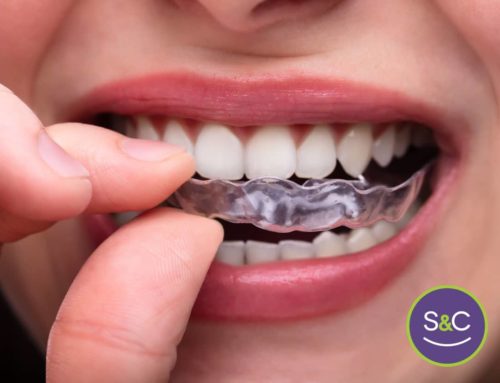 What Is the Difference Between Clear Braces and Clear Aligners?