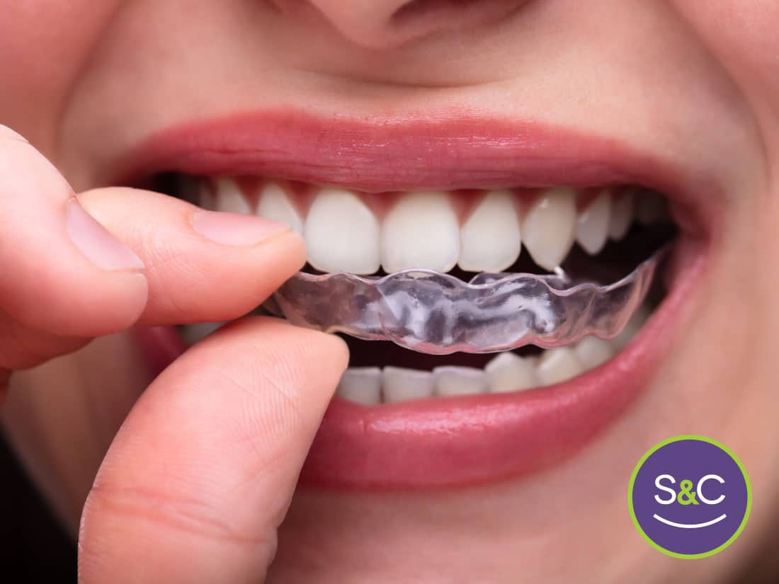 Clear aligners can help you realign your teeth and fix your smile