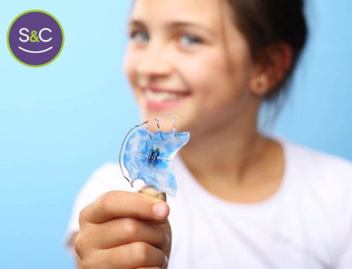 What Are the Differences Between Orthodontic Appliances?
