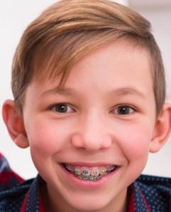 Early Orthodontics in Centennial, CO