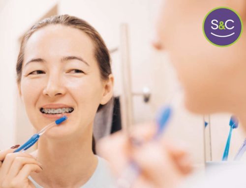 Oral Hygiene During Orthodontic Treatment