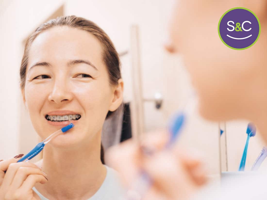 Your oral hygiene should be a main concern during the treatment with braces.
