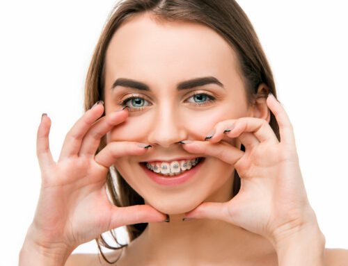 Do Braces Change Facial Structure? Understanding the Aesthetic Impact of Orthodontic Treatment